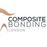 Composite Bonding  London